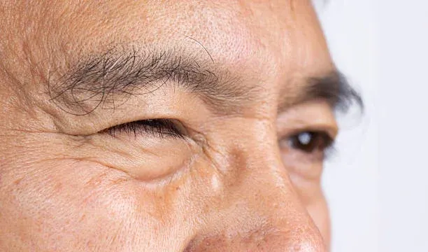 “자고 일어났더니 한쪽 얼굴이 안 움직인다” 안면신경마비 초기 증상일 수 있다