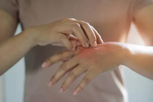 하얀 각질과 붉은 피부가 반복된다면, 건선을 의심해야 한다