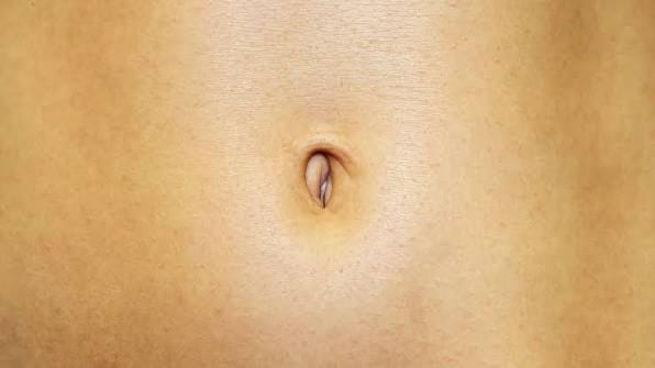 배꼽 속 검은 덩어리, 단순한 때가 아니라 ‘배꼽결석’일 수 있다