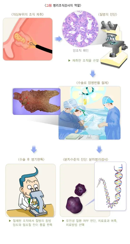 병리조직검사 검사 적응증 및 금기증 설명 이미지 1