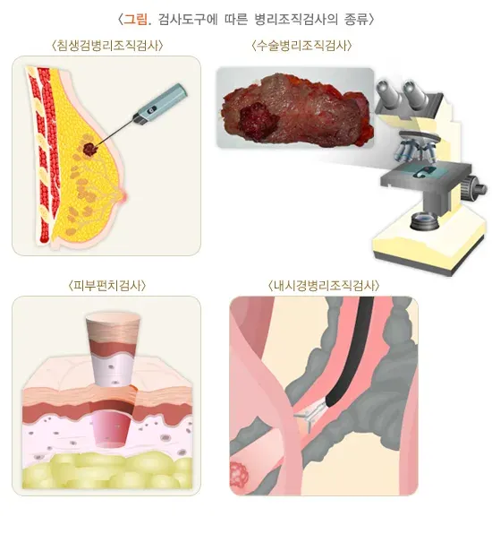 병리조직검사 검사 장비 설명 이미지 1
