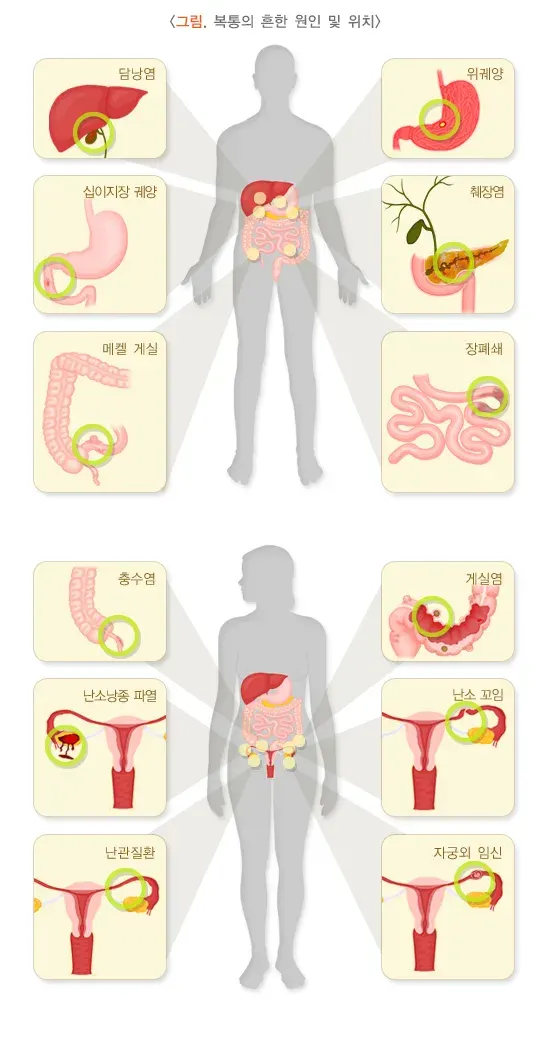 복통 진단 및 검사 설명 이미지 1