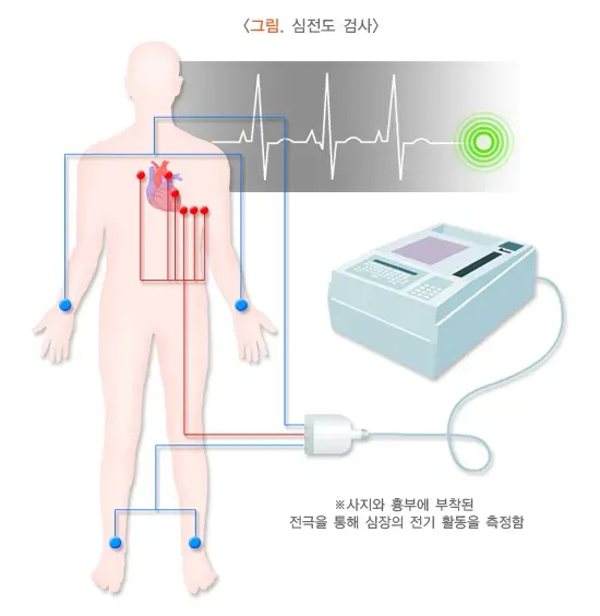부정맥 진단 및 검사 설명 이미지 1