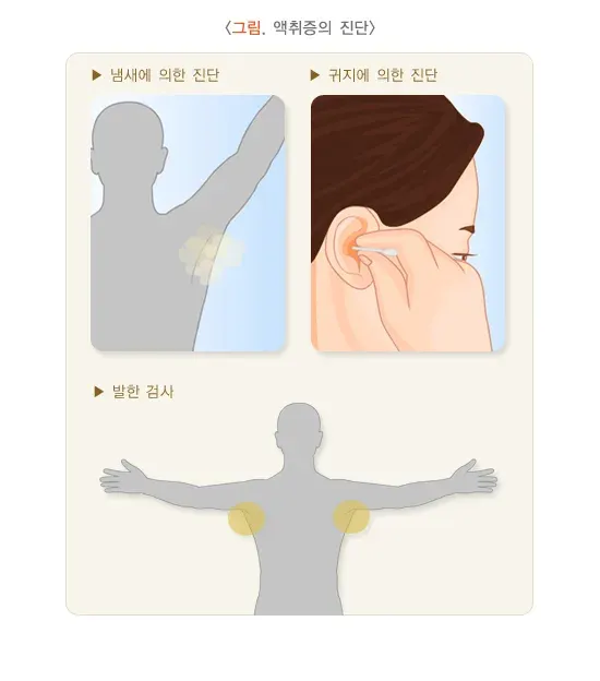 액취증 진단 및 검사 설명 이미지 1