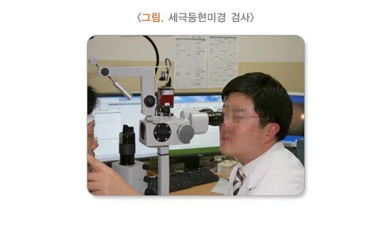 각막혼탁 및 반흔 진단 및 검사 설명 이미지 1