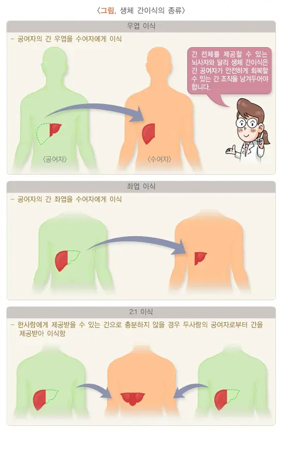 간이식수술 치료 방법 설명 이미지 2