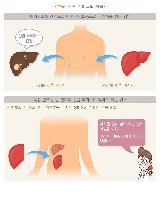 간이식수술 치료 방법 설명 이미지 3