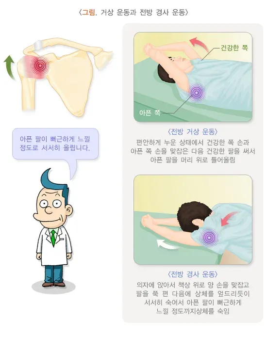 오십견 비약물 치료 설명 이미지 1