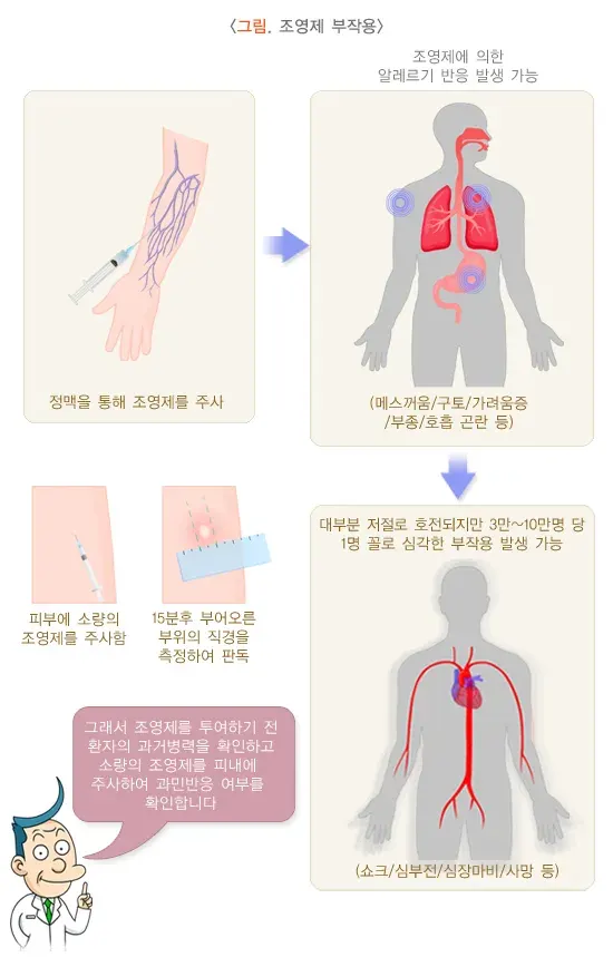 경정맥신우조영술 치료 관련 합병증 및 부작용 설명 이미지 1
