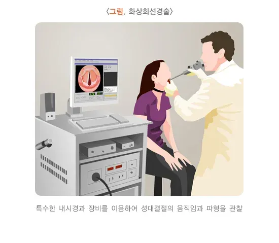 성대결절 진단 및 검사 설명 이미지 2