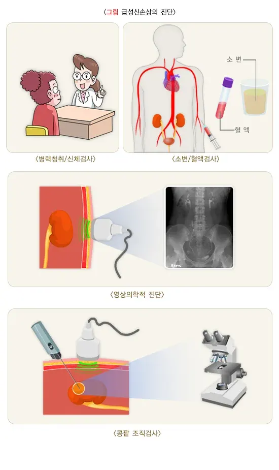 급성신손상(소아) 진단 및 검사 설명 이미지 1