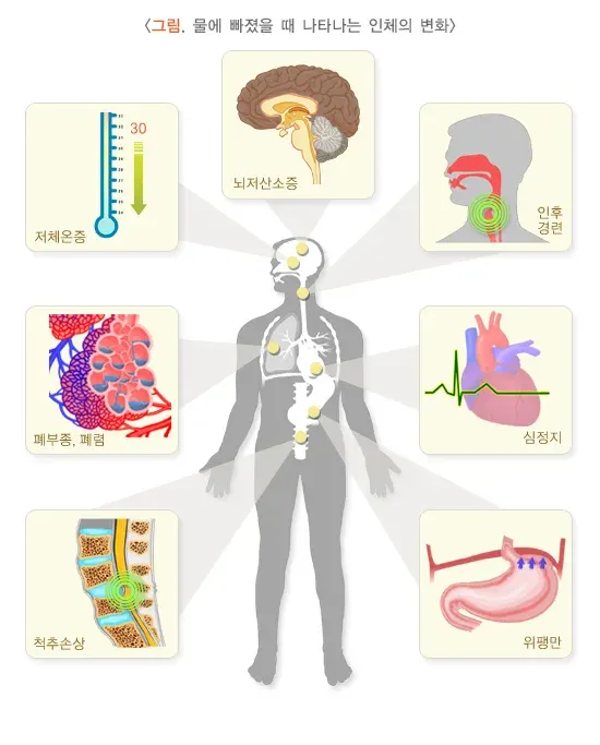 물에 빠짐 건강에 미치는 영향 설명 이미지 1