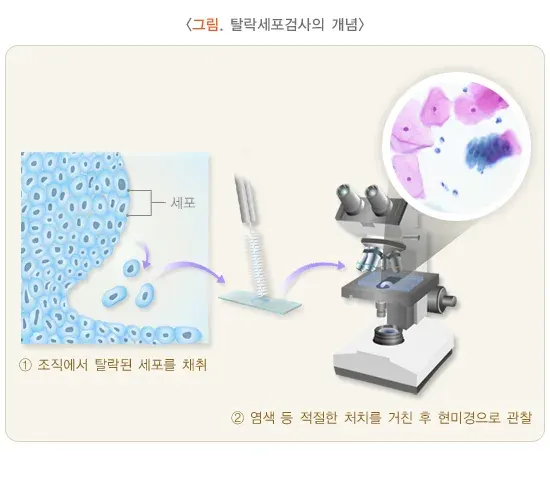 세포검사 검사 항목 설명 이미지 1