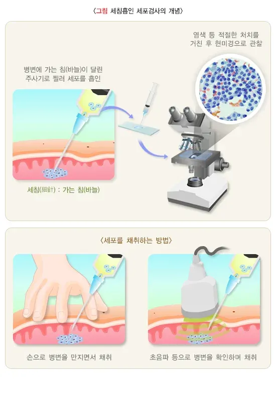 세포검사 검사 항목 설명 이미지 4