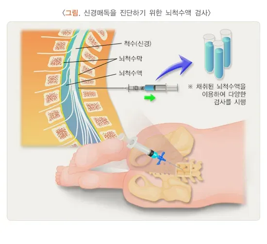 성매개감염병 진단 및 검사 설명 이미지 1