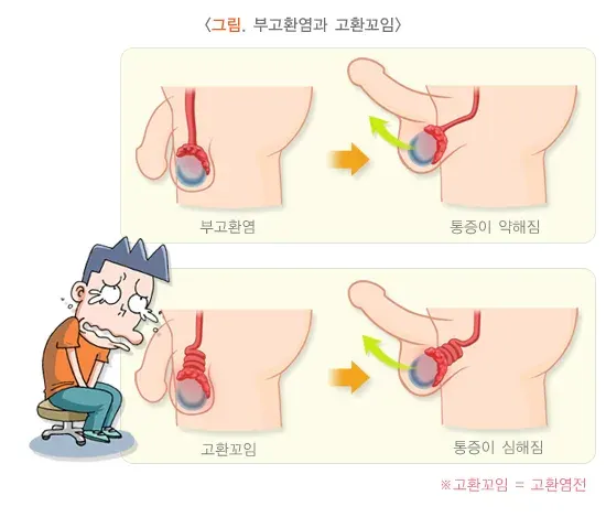 급성부고환염 진단 및 검사 설명 이미지 1