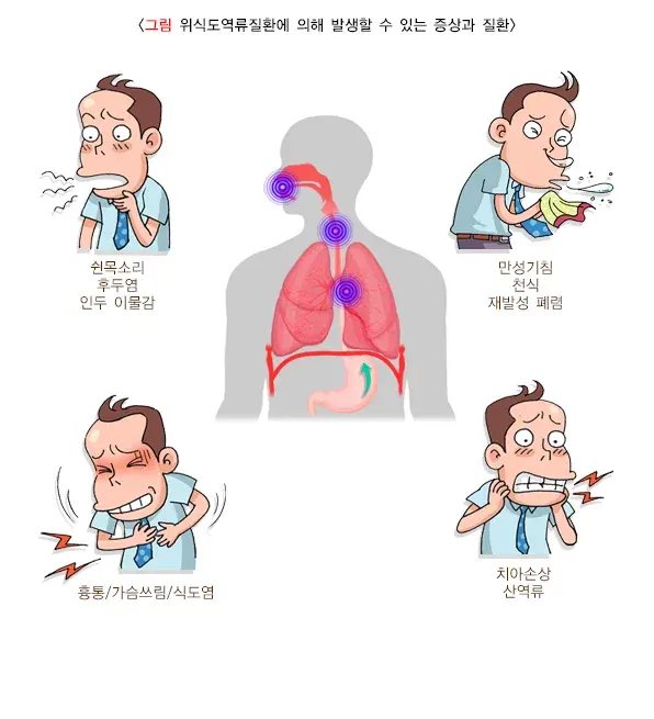 위식도역류질환 증상 설명 이미지 1