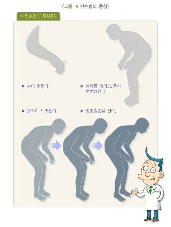 손떨림 종류 설명 이미지 1