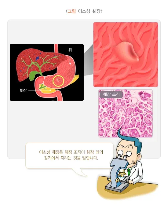 위용종 종류 설명 이미지 1