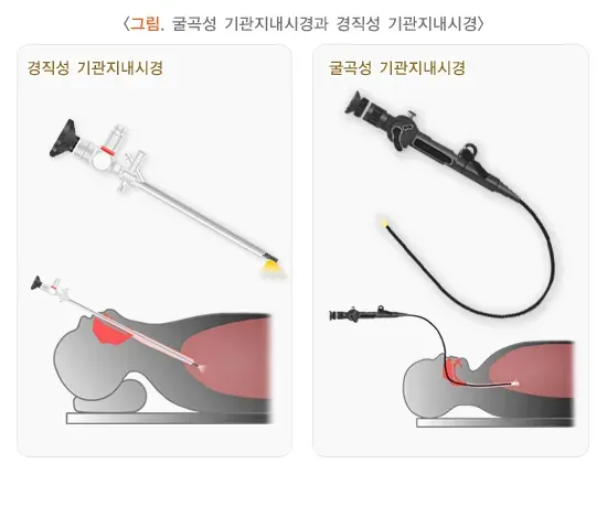 기관지 내시경 검사 검사 장비 설명 이미지 1