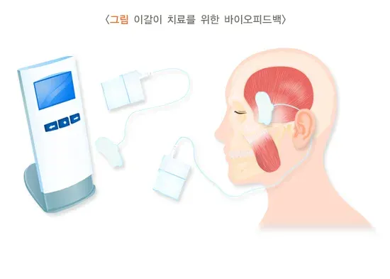 이갈이 비약물 치료 설명 이미지 3