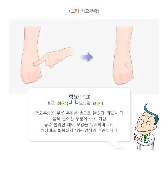 노인 부종 진단 및 검사 설명 이미지 1