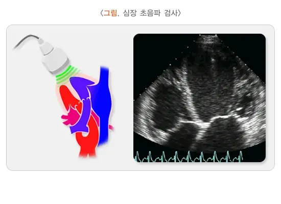 폐부종 진단 및 검사 설명 이미지 2
