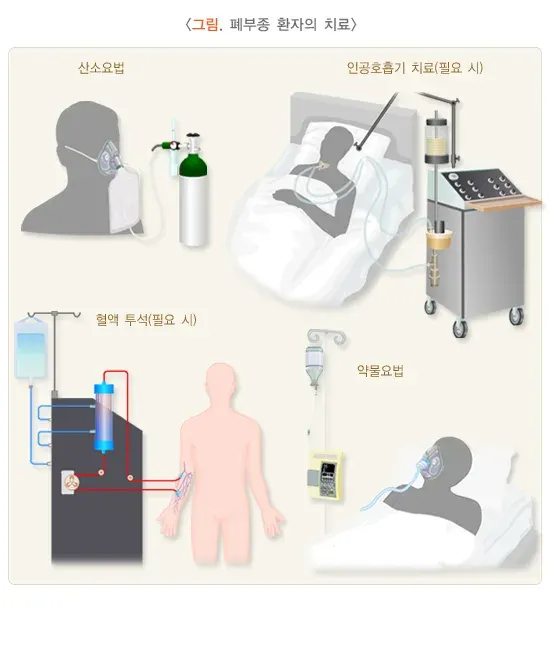 폐부종 치료 설명 이미지 1