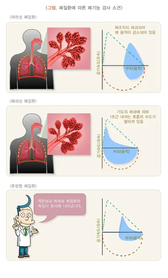 폐기능검사 검사 결과 해석 설명 이미지 3