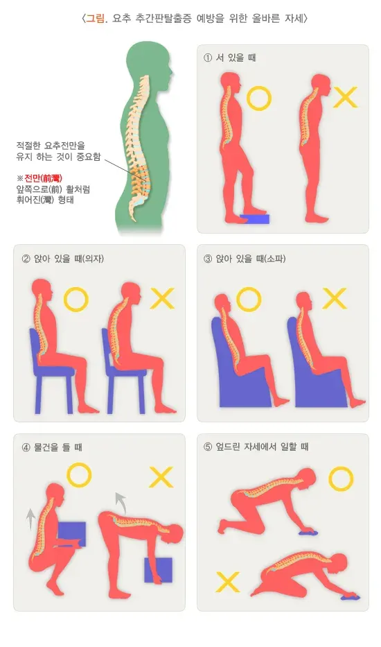 추간판탈출증(디스크) 자가 관리 설명 이미지 1