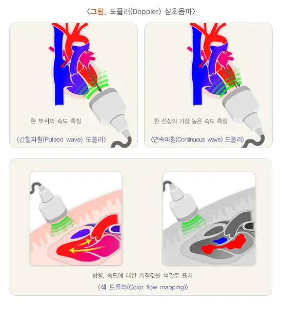 심초음파검사 검사 장비 설명 이미지 3