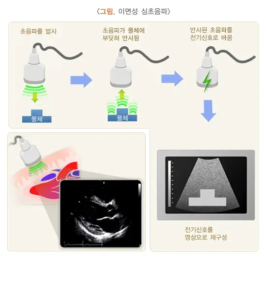 심초음파검사 검사 장비 설명 이미지 1