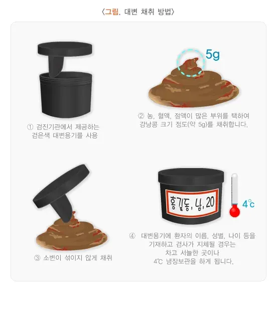 대변 및 잠혈검사 검사 검체 설명 이미지 1
