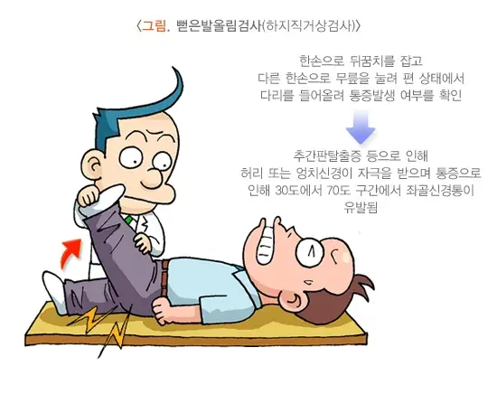 좌골신경통 진단 및 검사 설명 이미지 1