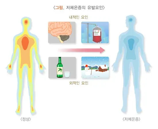 저체온증 발생원/원인 설명 이미지 1