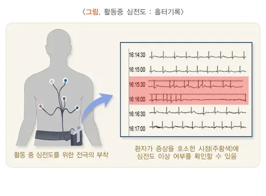 심전도검사 검사 장비 설명 이미지 3