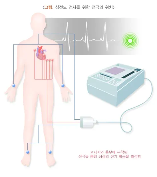심전도검사 검사 절차 설명 이미지 1