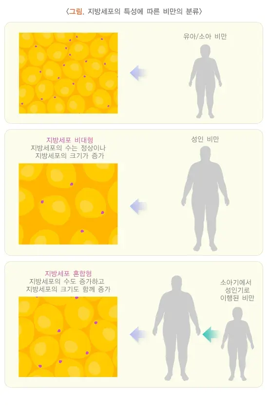 소아 비만 원인 설명 이미지 1
