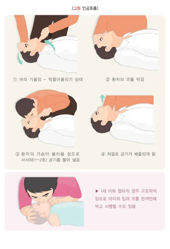 심폐소생술 치료 방법 설명 이미지 7