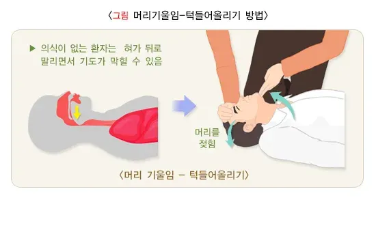 심폐소생술 치료 방법 설명 이미지 6