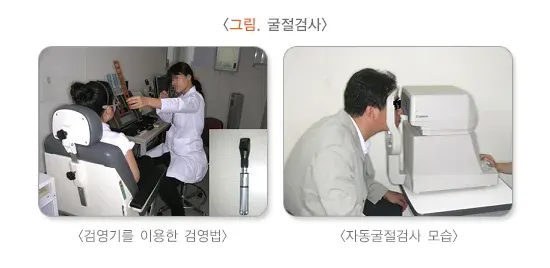 굴절이상(근시, 원시, 난시) 진단 및 검사 설명 이미지 1