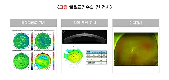 근시교정수술 치료 관련 검사 설명 이미지 1