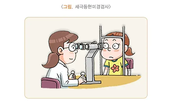 덧눈꺼풀 진단 및 검사 설명 이미지 1