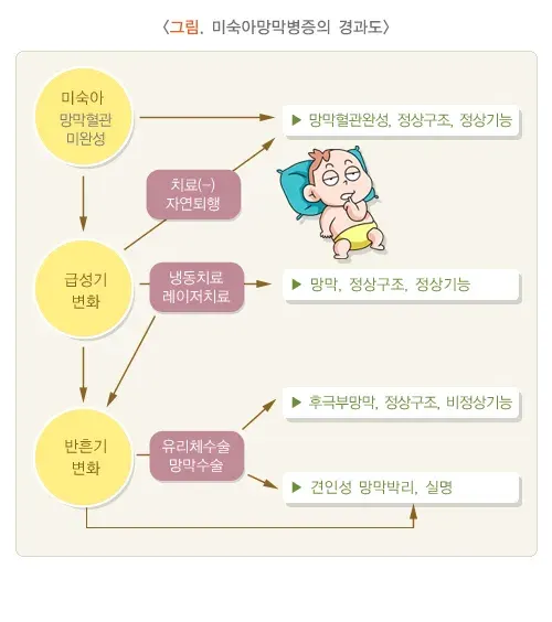 미숙아망막병증 경과 및 예후 설명 이미지 1