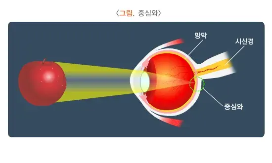 저시력 연관 증상 설명 이미지 1