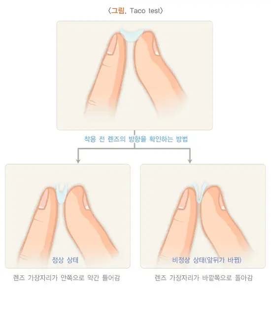 콘택트렌즈 치료 관련 주의사항 설명 이미지 1