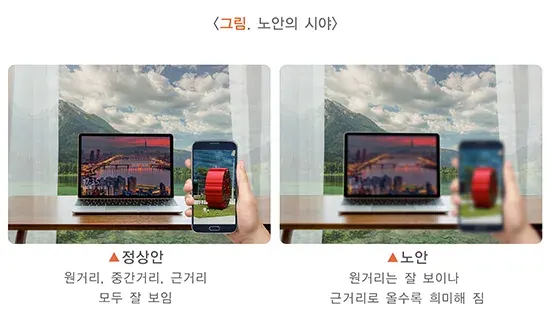 노안 연관 증상 설명 이미지 1