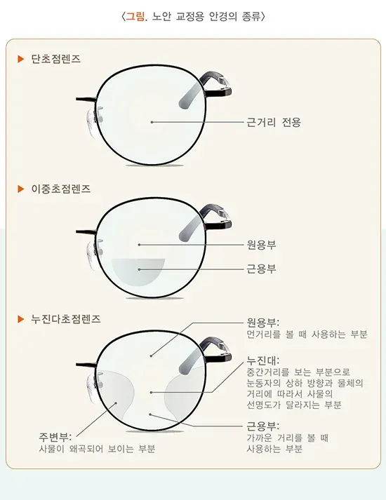 노안 치료 설명 이미지 1