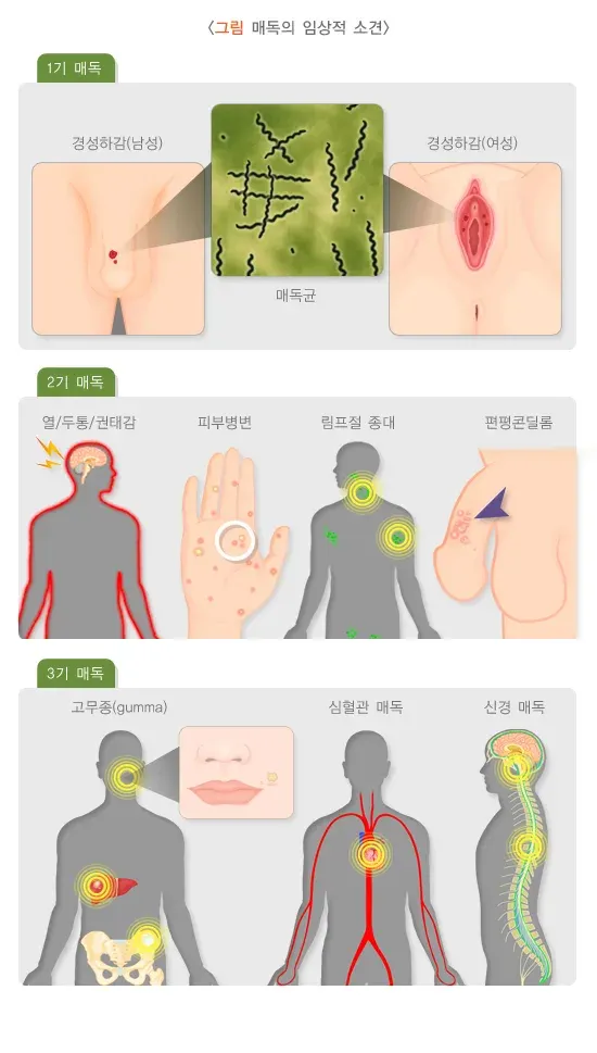 성매개감염병 증상 설명 이미지 1