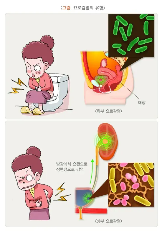 요로감염 종류 설명 이미지 1